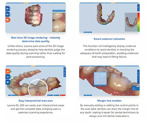 intraooral scanner-011.jpg