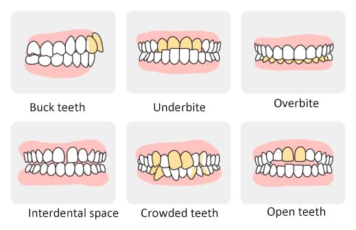 What is orthodontics (1-1).jpg