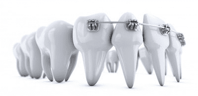 What is orthodontics (3).png